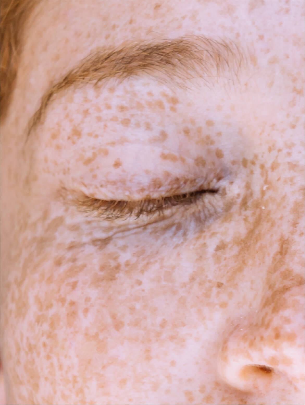 Dark Spot Face Cream with Kojic Acid